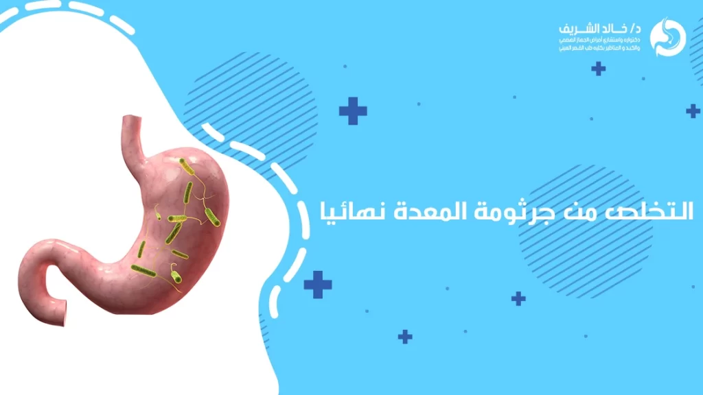 التخلص من جرثومة المعدة نهائيا