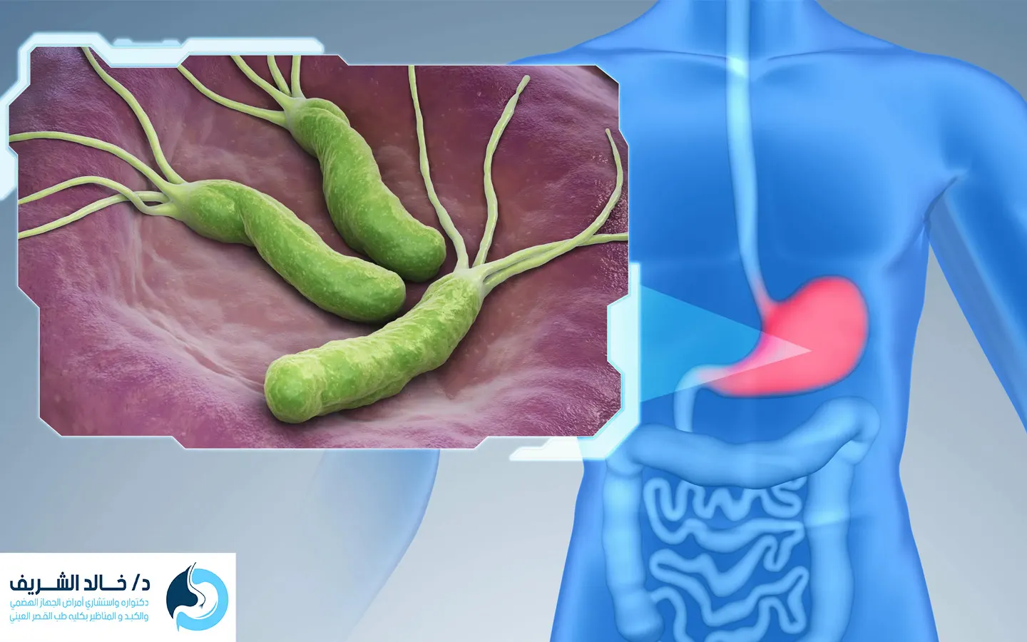 التخلص من جرثومة المعدة نهائيا