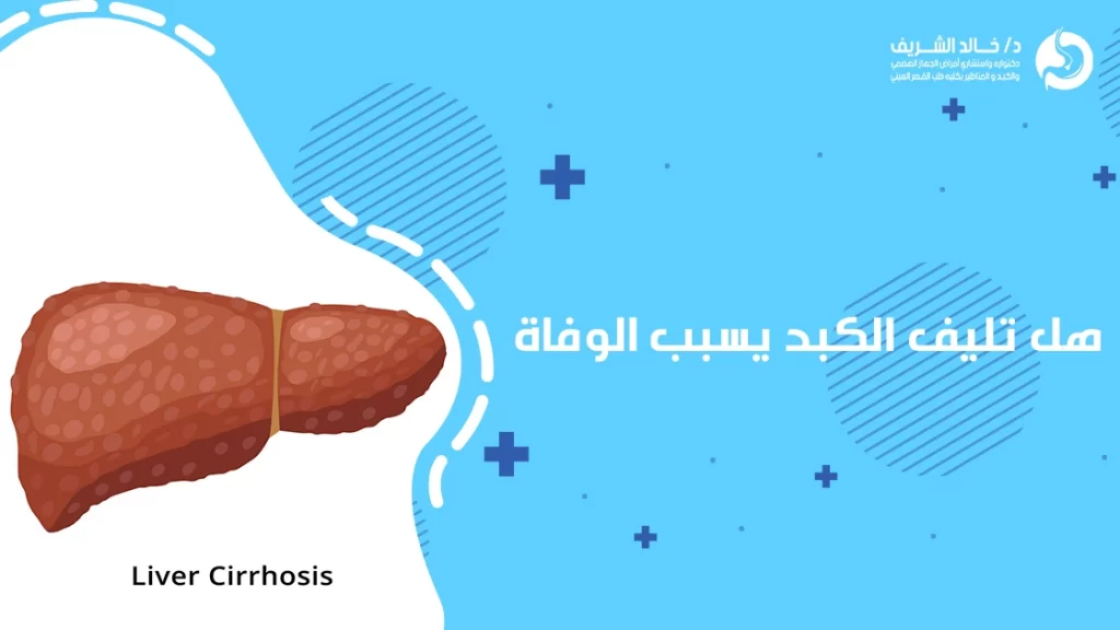 هل تليف الكبد يسبب الوفاة