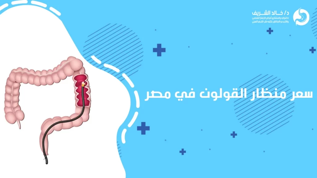 سعر منظار القولون في مصر