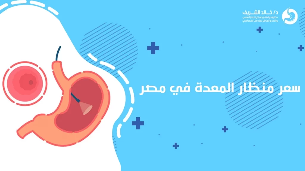 سعر منظار المعدة في مصر