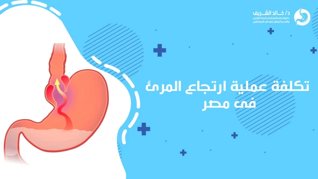 تكلفة عملية ارتجاع المرئ فى مصر