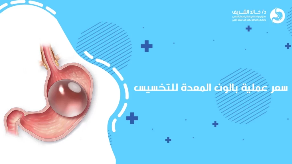 سعر عملية بالون المعدة للتخسيس في مصر 2024