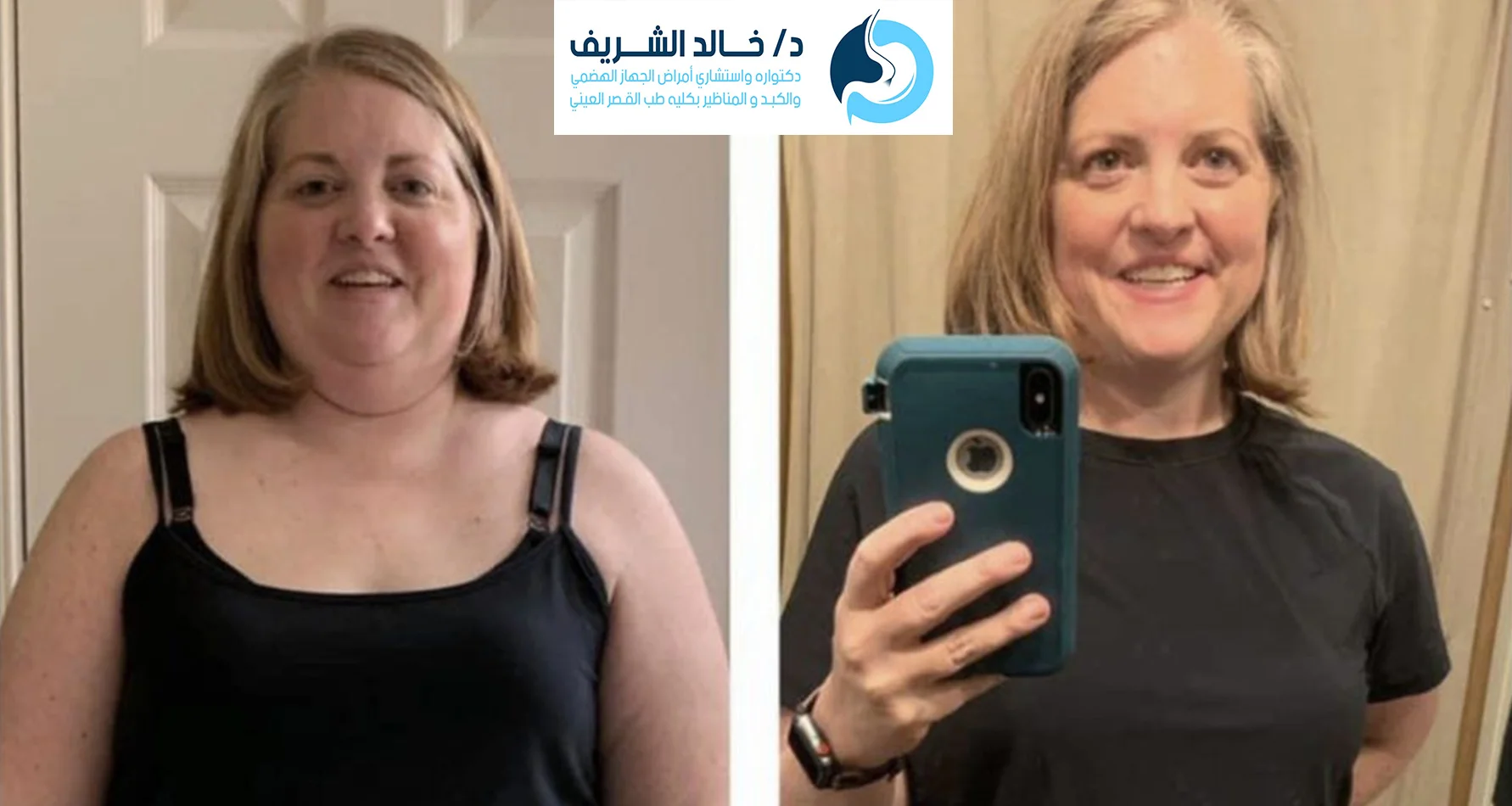 نتائج تركيب الكبسولة الذكية