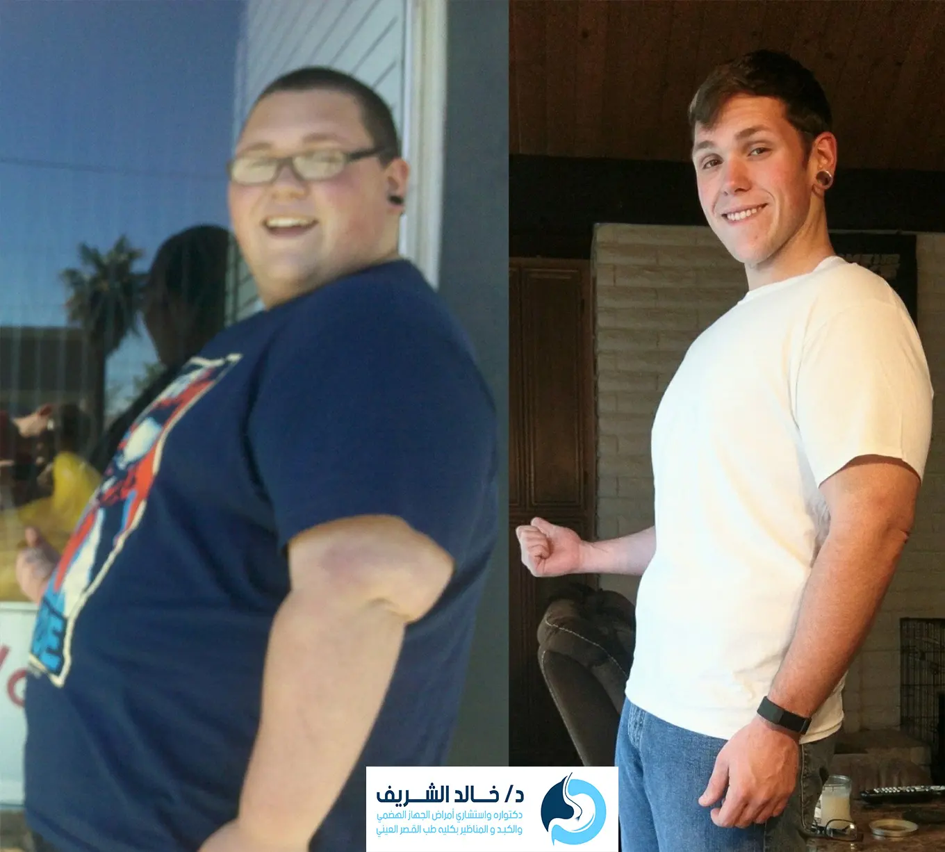 نتائج تركيب الكبسولة الذكية