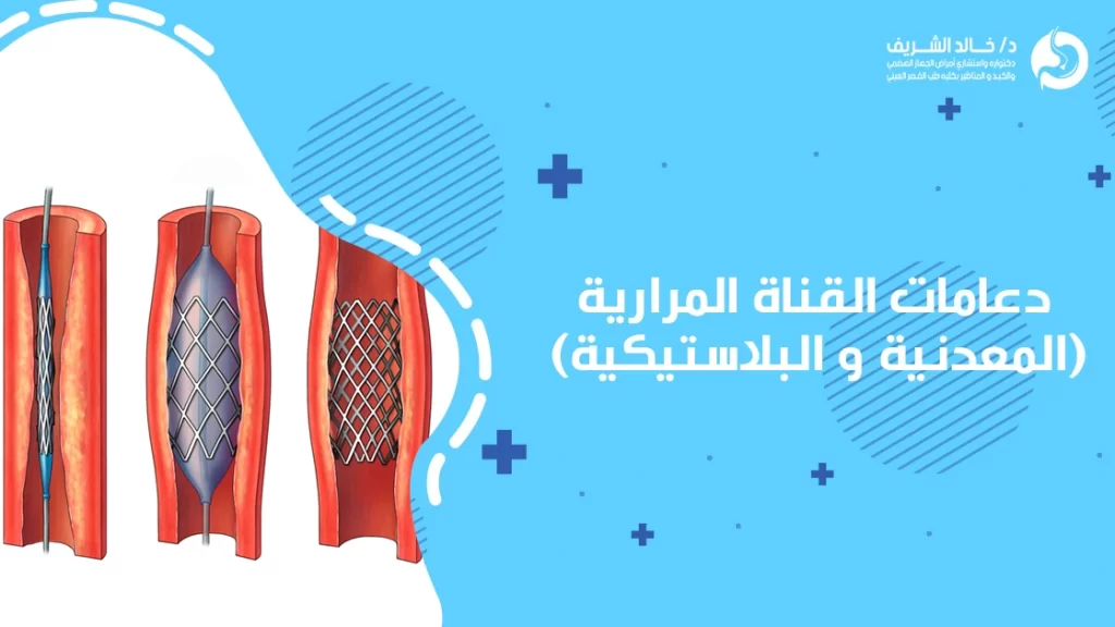 دعامة القناة المرارية