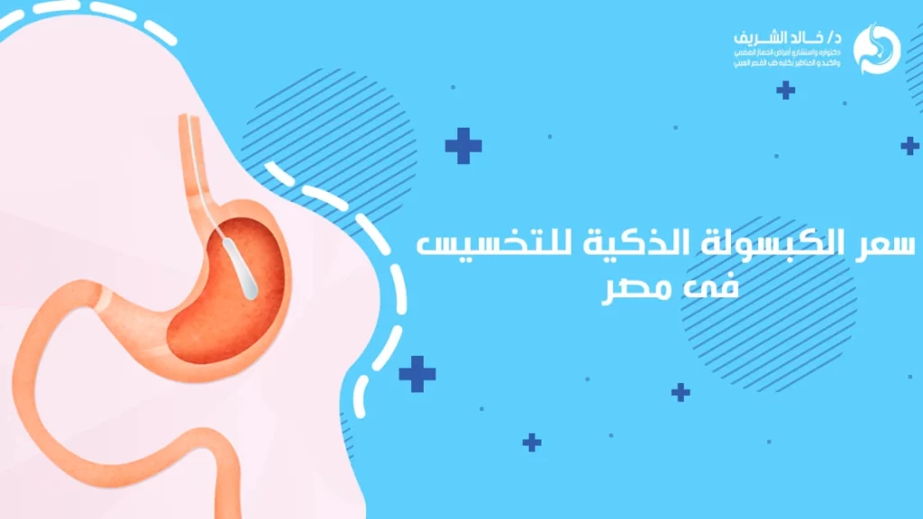 سعر الكبسولة الذكية للتخسيس في مصر