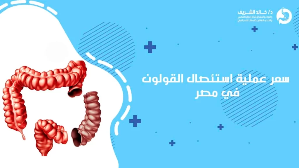 سعر عملية استئصال القولون في مصر