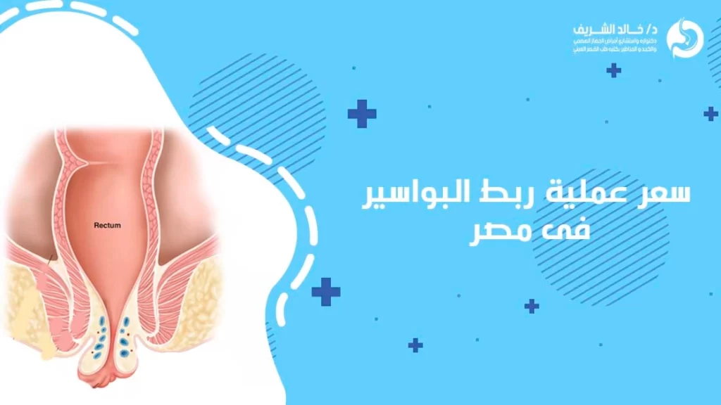 سعر عملية ربط البواسير فى مصر
