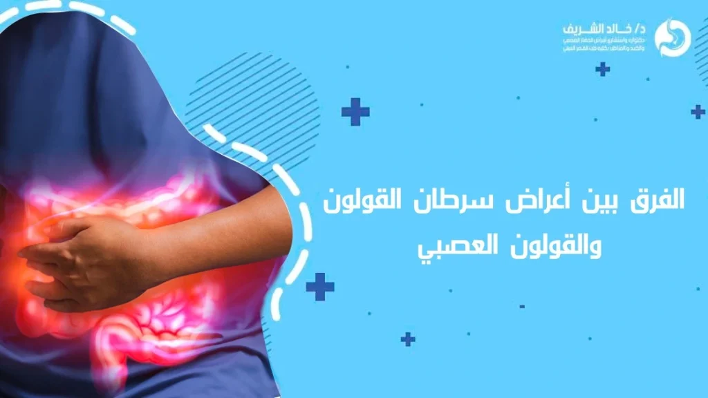 الفرق بين أعراض سرطان القولون والقولون العصبي