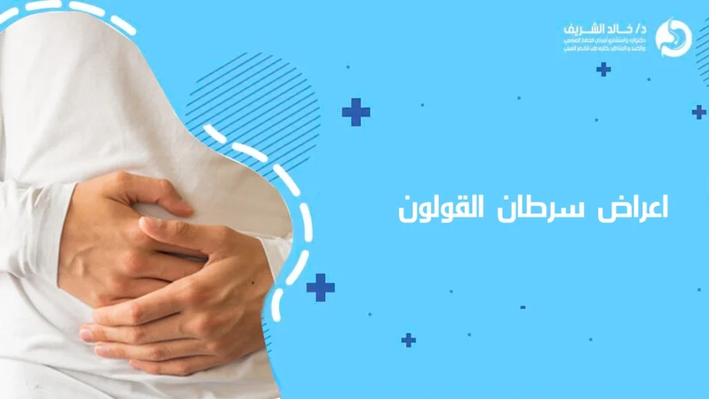 اعراض سرطان القولون دكتور خالد الشريف