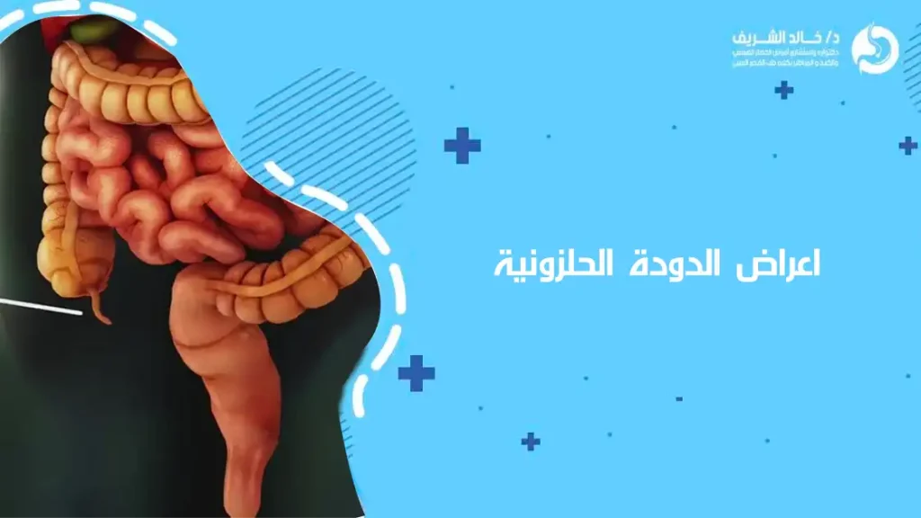 اعراض البكتيريا الحلزونية