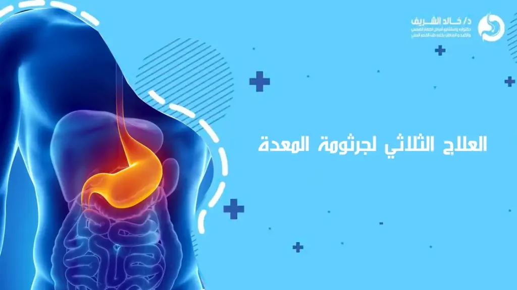 العلاج الثلاثي لجرثومة المعدة