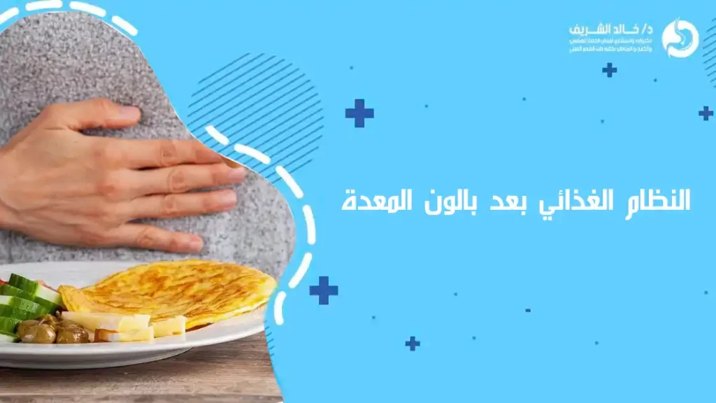 النظام الغذائي بعد بالون المعدة