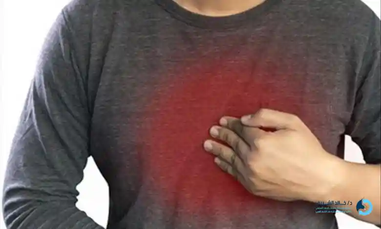 تجربتي مع عملية ارتجاع المرئ