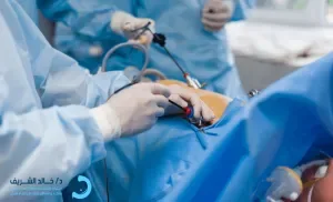 عمليات تركيب دعامة في القنوات المرارية 