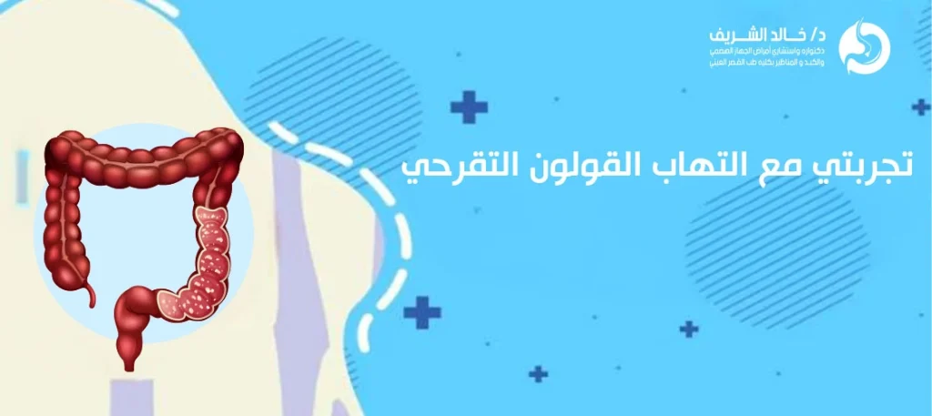 تجربتي مع التهاب القولون التقرحي