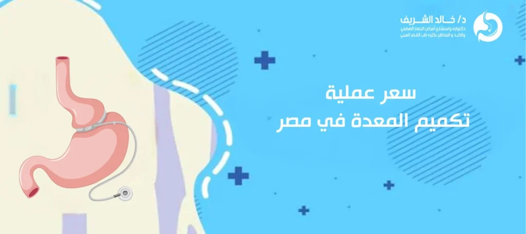 سعر عملية تكميم المعدة في مصر