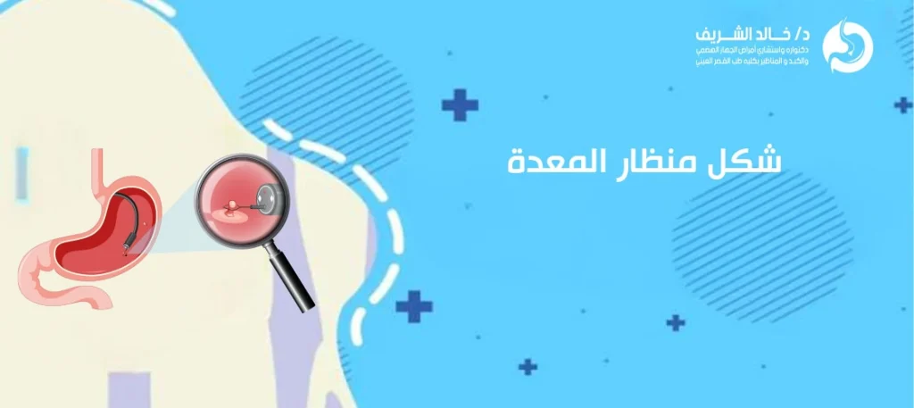 شكل منظار المعدة