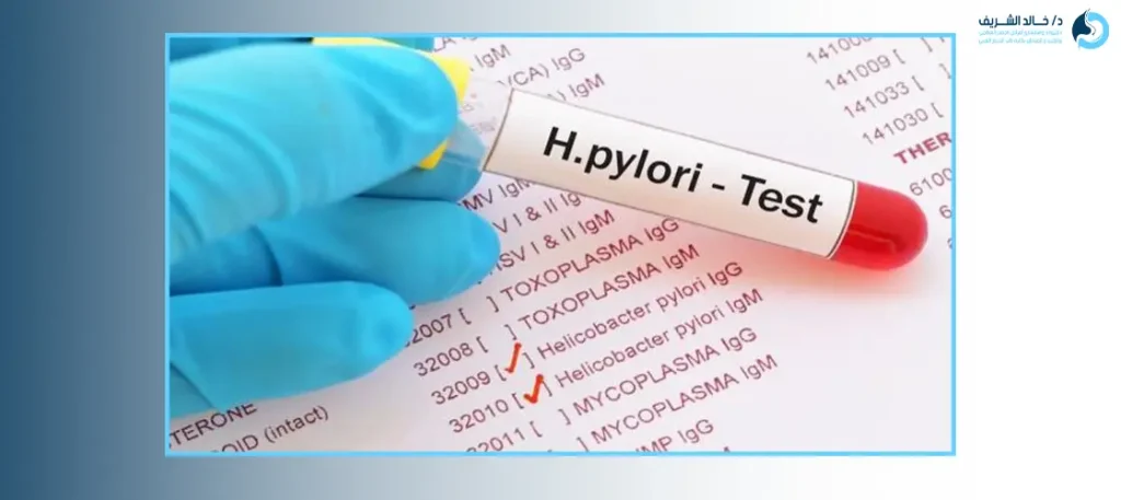 قراءة نتيجة تحليل جرثومة المعدة positive