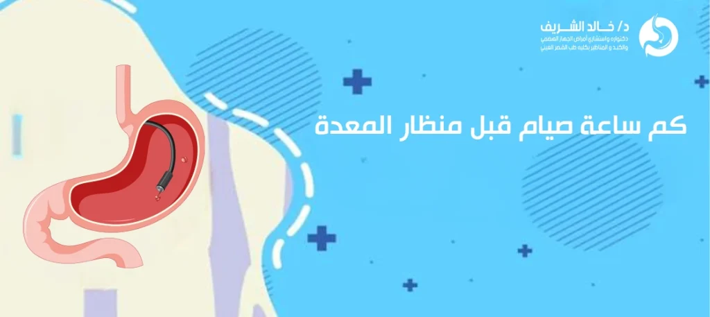 كم ساعة صيام قبل منظار المعدة