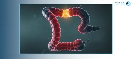 التهاب القولون المجهري