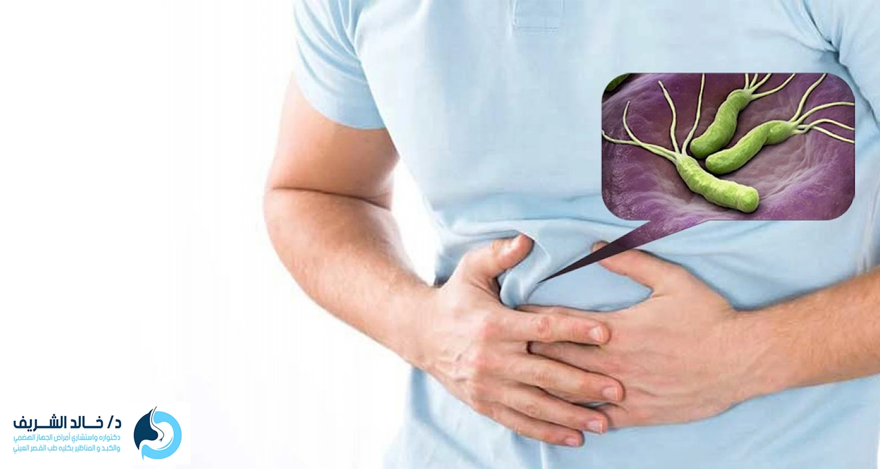 علاج جرثومة المعدة
